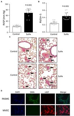 Upregulation of Aquaporin 1 Mediates Increased Migration and Proliferation in Pulmonary Vascular Cells From the Rat SU5416/Hypoxia Model of Pulmonary Hypertension